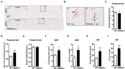 Deficiency of TRIM32 Impairs Motor Function and Purkinje Cells in Mid-Aged Mice